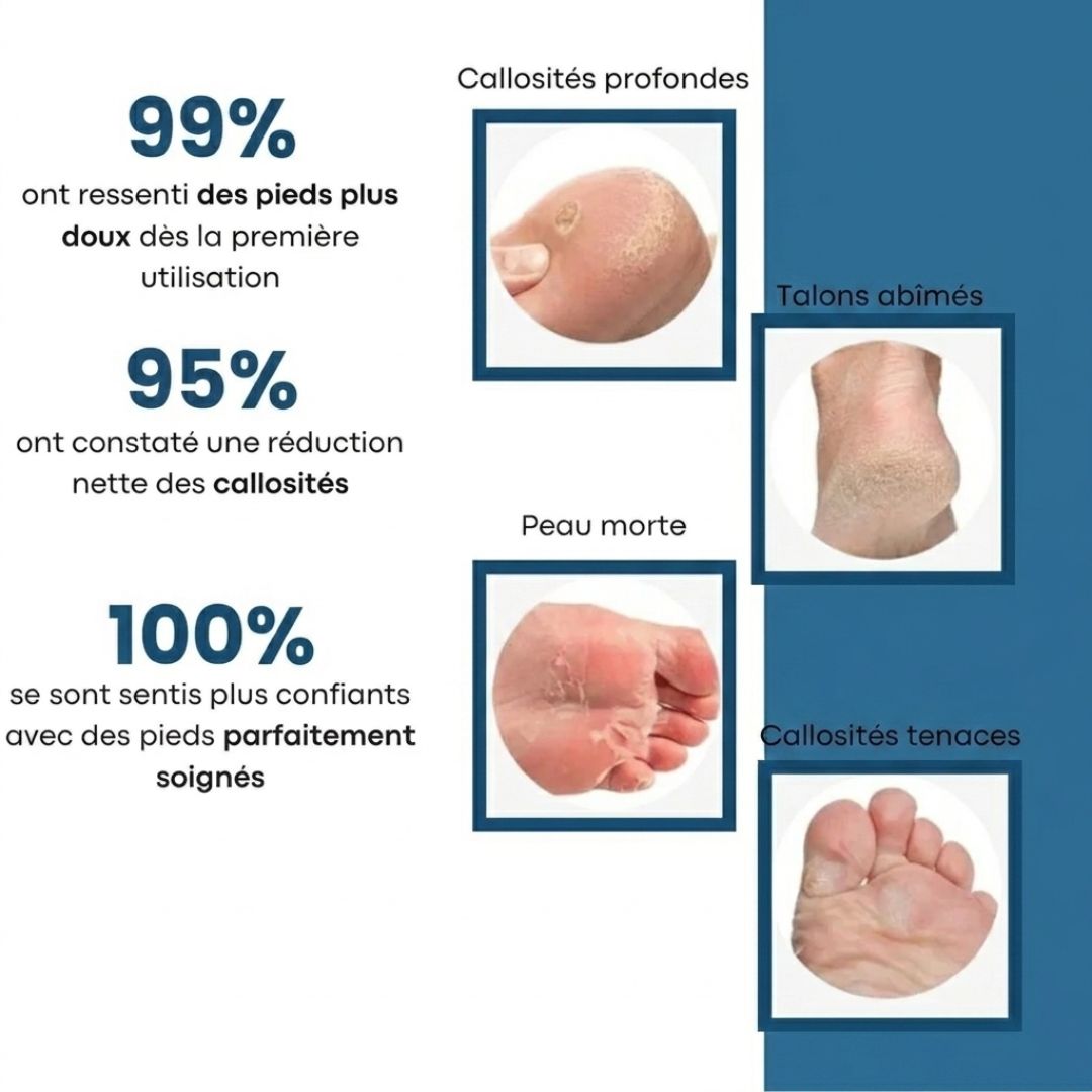 Râpe exfoliante pieds – Des talons doux sans effort