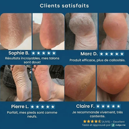 Râpe exfoliante pieds – Des talons doux sans effort