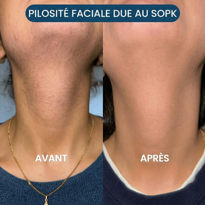 Épilateur Visage 2-en-1 – Douceur et précision instantanées