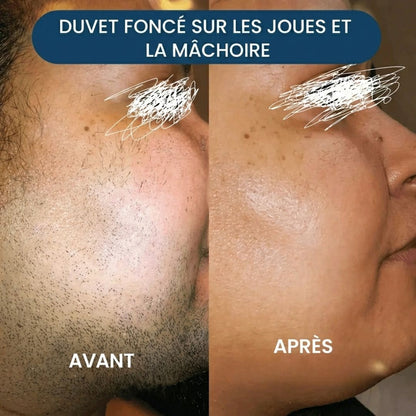 Épilateur Visage 2-en-1 – Douceur et précision instantanées
