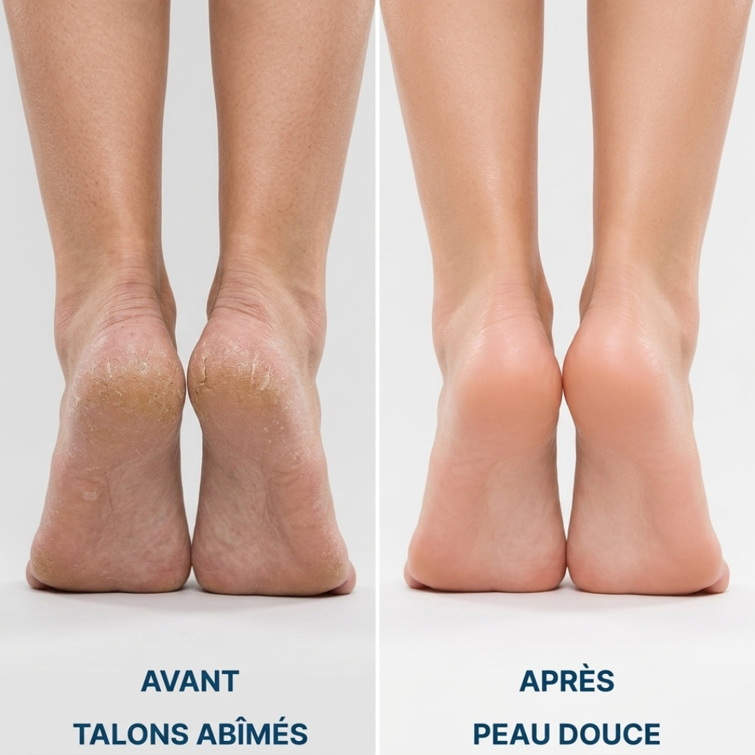 PediSmooth Pro – Des pieds doux et soignés en quelques gestes