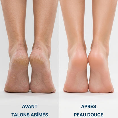 PediSmooth Pro – Des pieds doux et soignés en quelques gestes