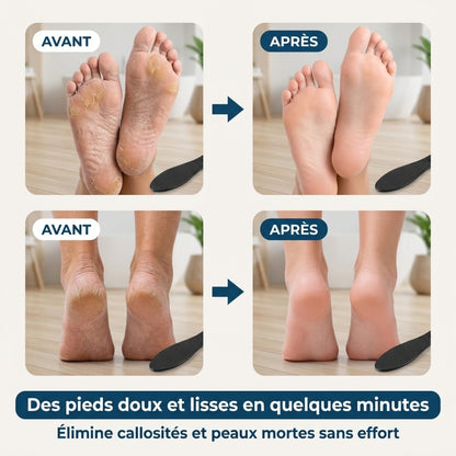 PediSmooth Pro – Des pieds doux et soignés en quelques gestes