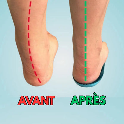 Semelles Confort+ – Soulagez vos pieds et marchez sans douleur