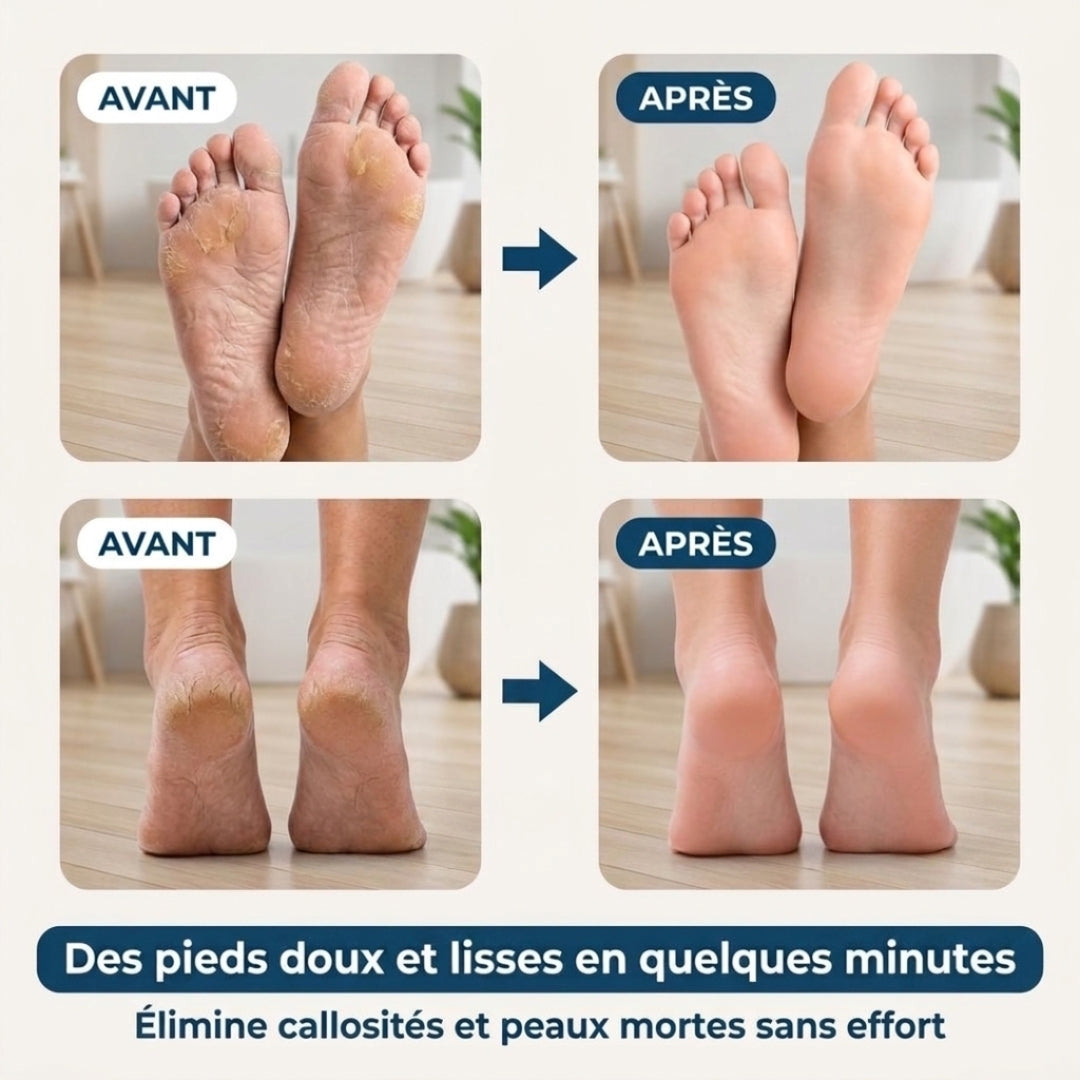 PediSmooth Pro – Des pieds doux et soignés en quelques gestes