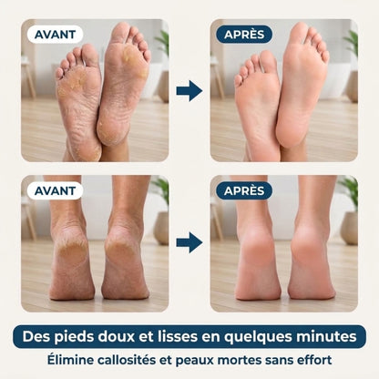 PediSmooth Pro – Des pieds doux et soignés en quelques gestes