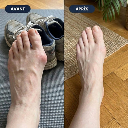 Correcteur Pied Confort – Retrouvez une marche plus agréable au quotidien