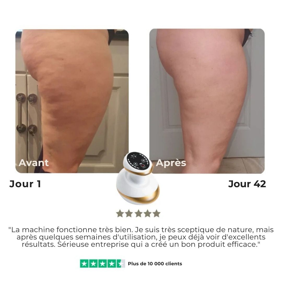 SmoothTone™ – Dispositif de Massage Raffermissant