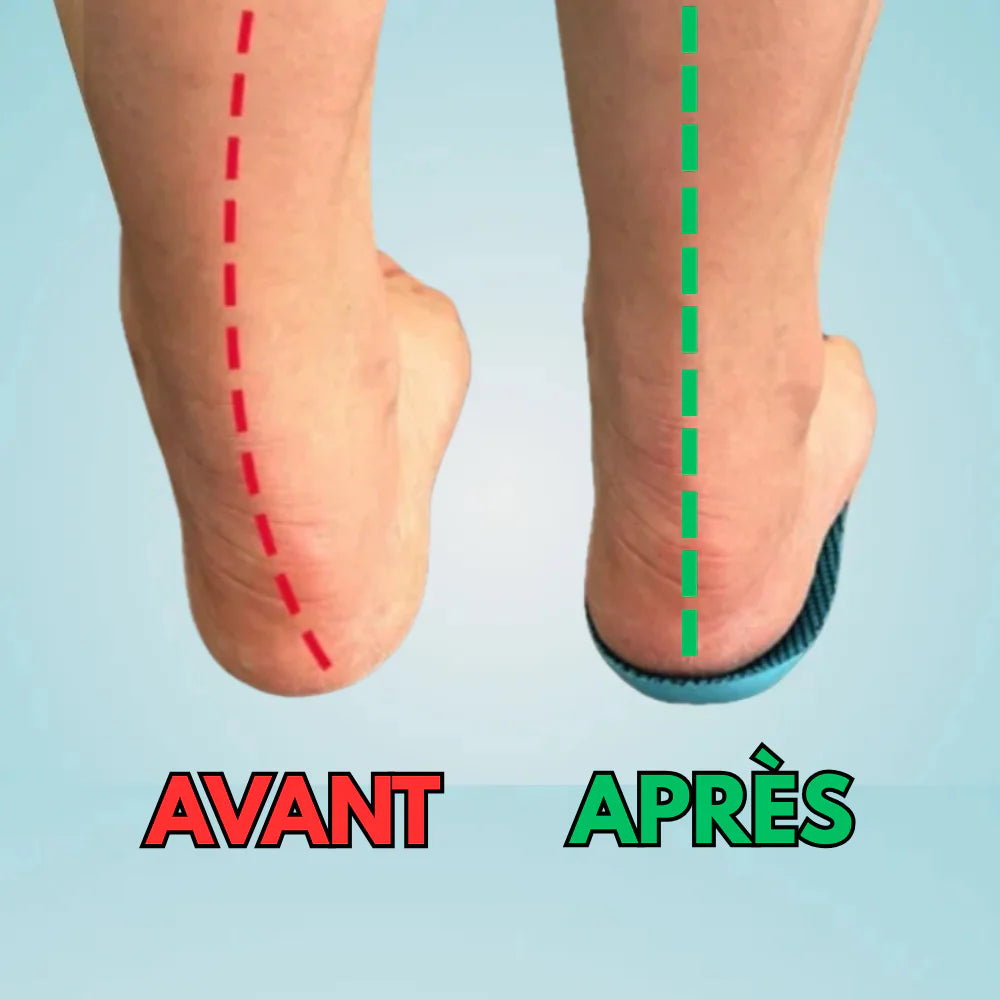 Semelles Confort+ – Soulagez vos pieds et marchez sans douleur