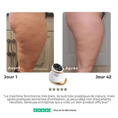 SmoothTone™ – Dispositif de Massage Raffermissant