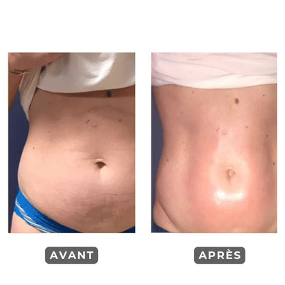 WoodSculpt – Rouleau de Massage en Bois