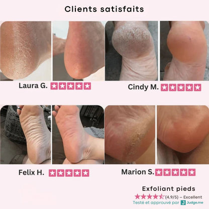 Râpe exfoliante pieds – Des talons doux sans effort