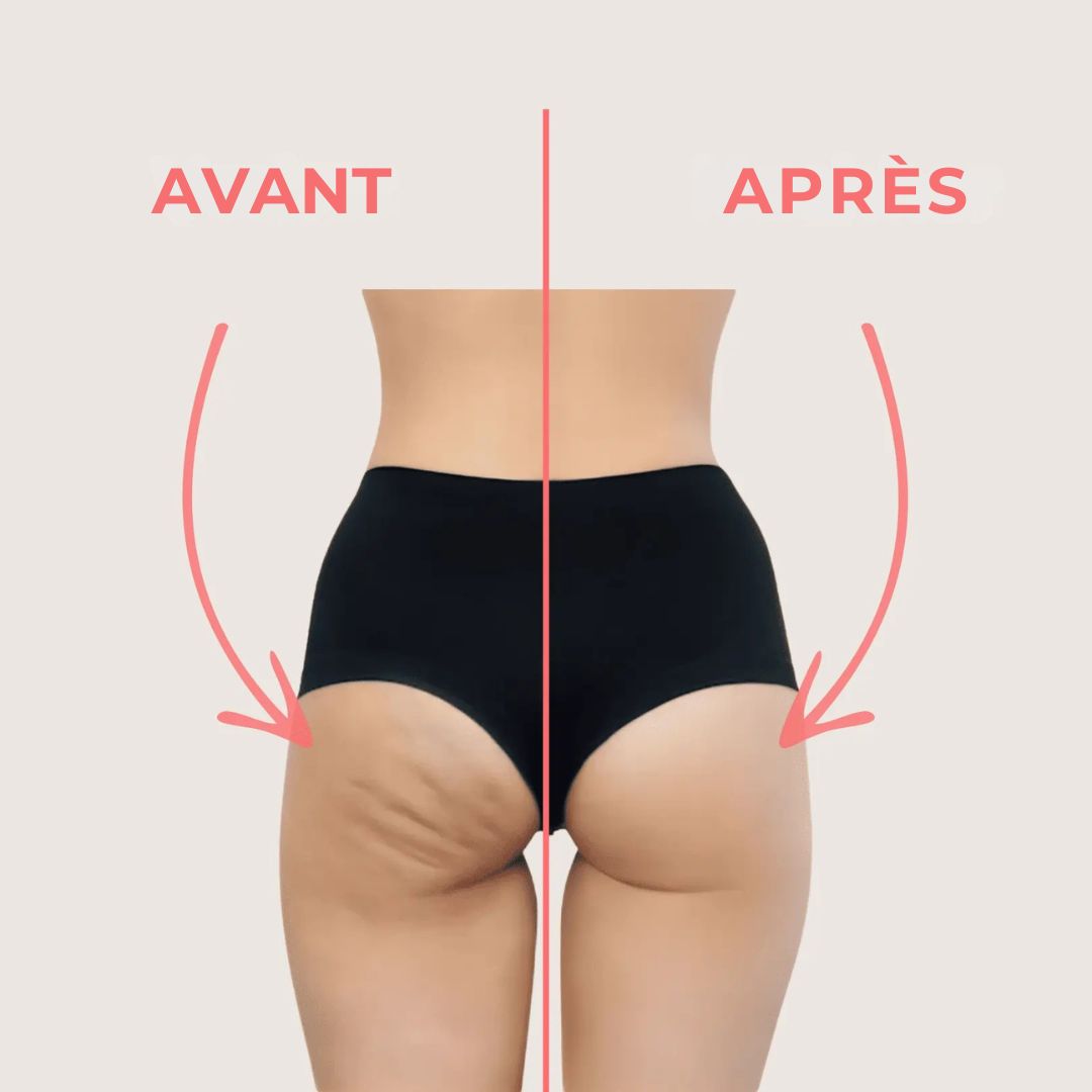 Roll’Skin – L’accessoire malin pour une peau plus lisse