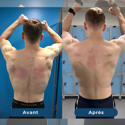 SpineFit | Corrige votre posture et apaise vos douleurs dorsales