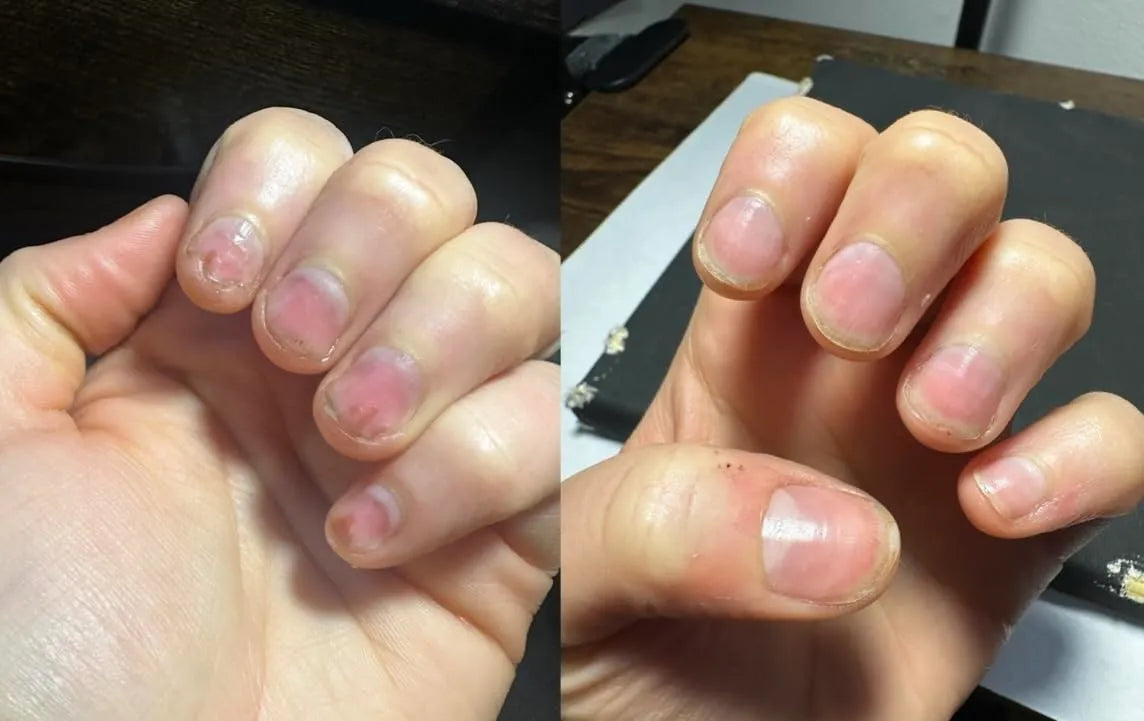 Nagelpflege-Stift – Repariert & stärkt Ihre Nägel in wenigen Tagen