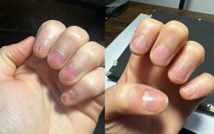 Nagelpflege-Stift – Repariert & stärkt Ihre Nägel in wenigen Tagen