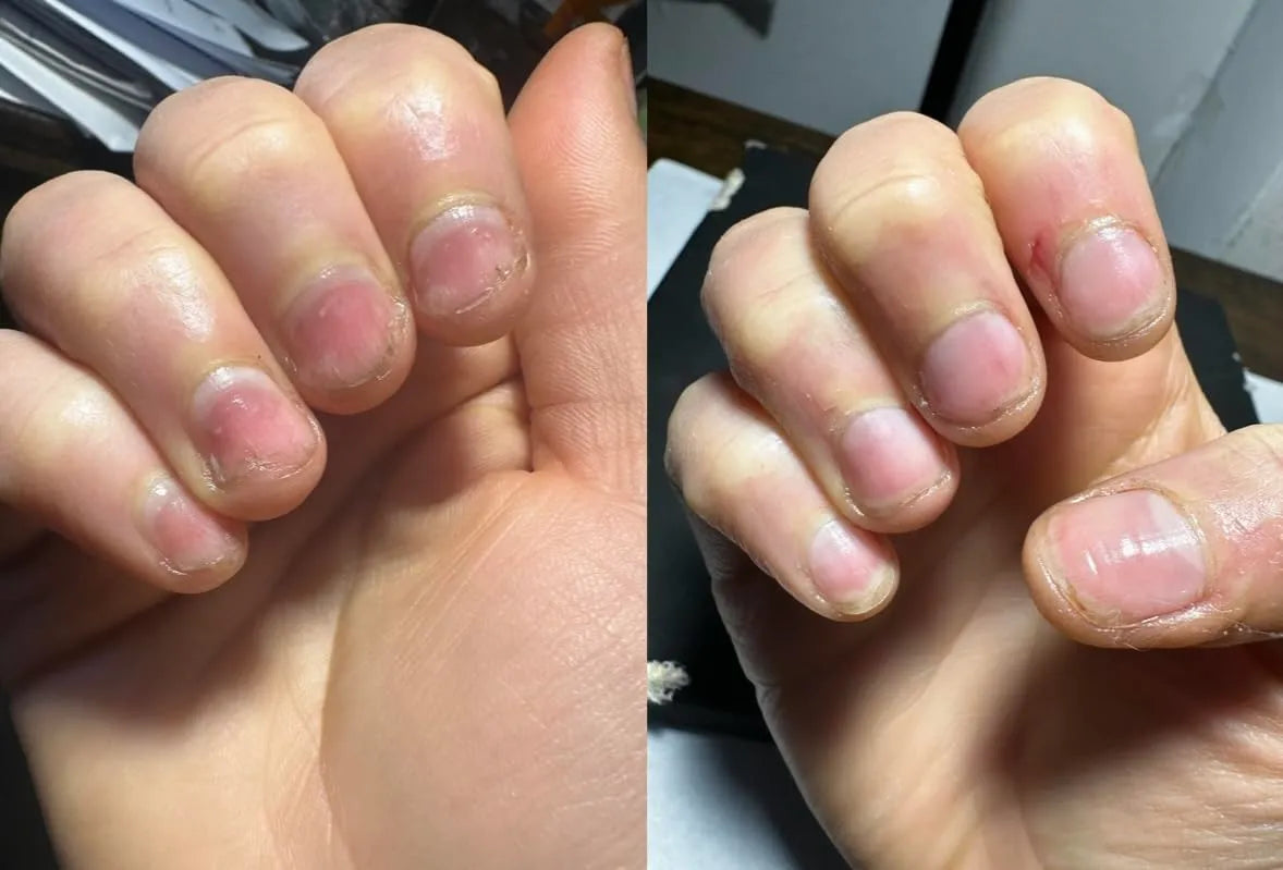 Nagelpflege-Stift – Repariert & stärkt Ihre Nägel in wenigen Tagen