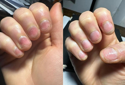 Nagelpflege-Stift – Repariert & stärkt Ihre Nägel in wenigen Tagen