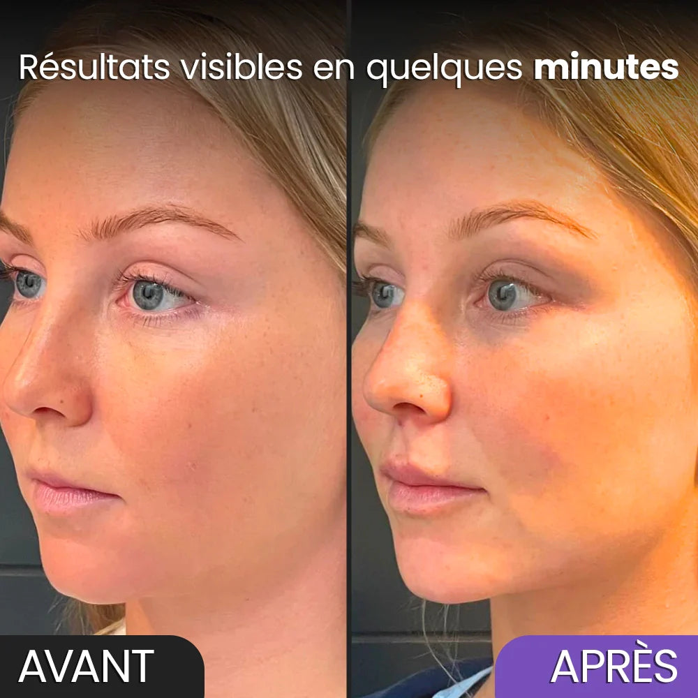 Vitaloria – Redessinez vos traits, illuminez votre teint