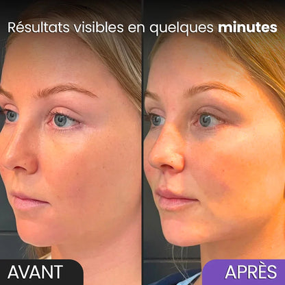 Vitaloria – Redessinez vos traits, illuminez votre teint